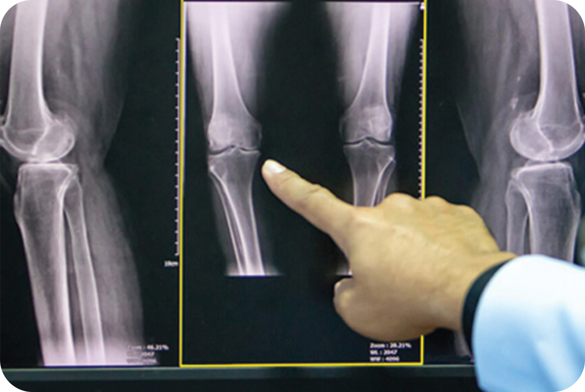 symptoms and diagnosis symptoms and diagnosis