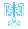 skeletal abnormalities